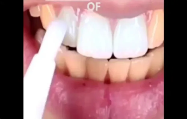 Teeth Whitening Pen