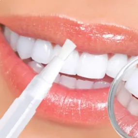 Teeth Whitening Pen